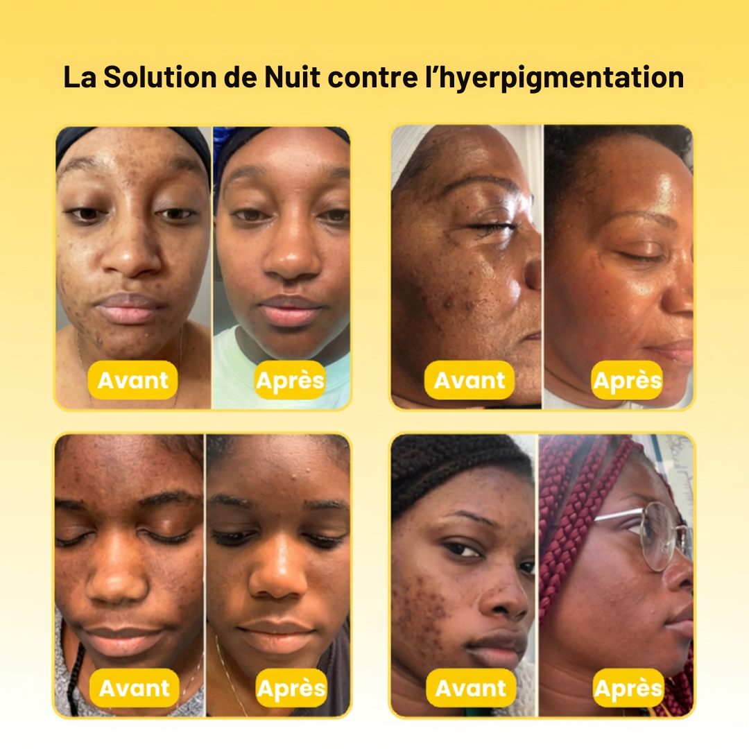 Masque anti-taches au curcuma et à l'acide kojique