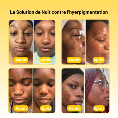 Masque anti-taches au curcuma et à l'acide kojique