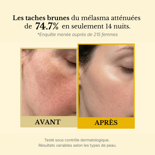 Masque enveloppant  au curcuma et à l'acide kojique