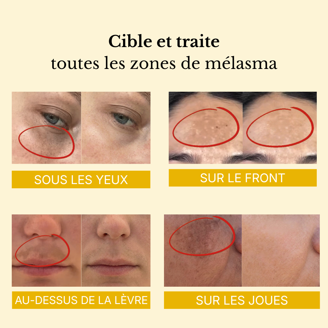 Masque enveloppant  au curcuma et à l'acide kojique