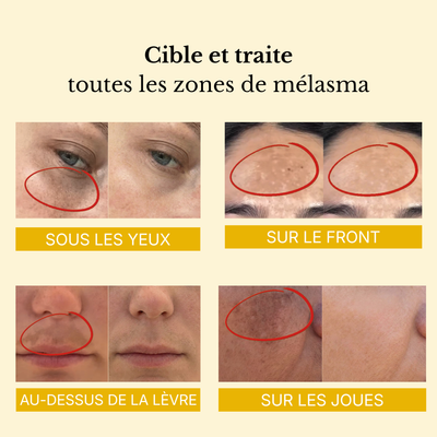 Masque enveloppant  au curcuma et à l'acide kojique
