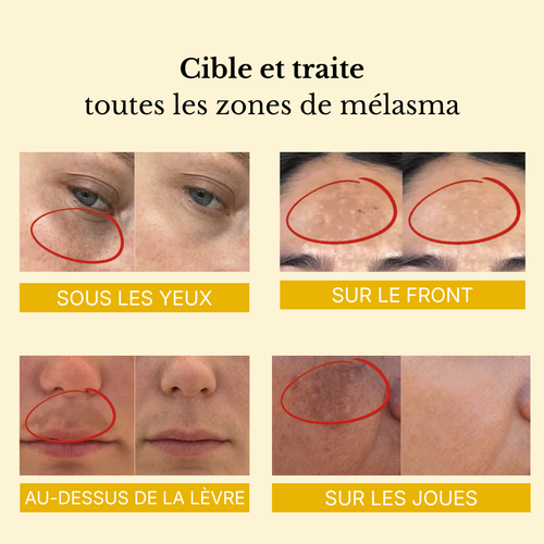 Masque enveloppant  au curcuma et à l'acide kojique